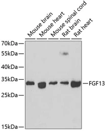 Anti-FGF13 antibody used in Western Blot (WB). GTX55620