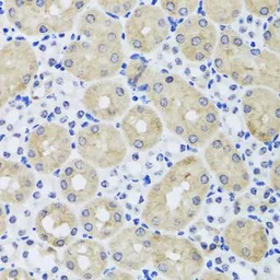 Anti-FGF13 antibody used in IHC (Paraffin sections) (IHC-P). GTX55620