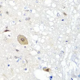 Anti-FGF13 antibody used in IHC (Paraffin sections) (IHC-P). GTX55620