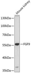 Anti-FGF9 antibody used in Western Blot (WB). GTX55621
