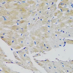 Anti-FGFR2 antibody used in IHC (Paraffin sections) (IHC-P). GTX55622