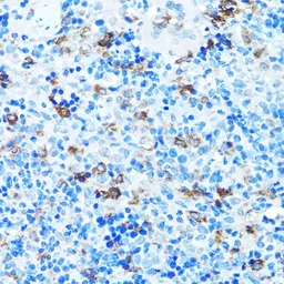 Anti-FGFR2 antibody used in IHC (Paraffin sections) (IHC-P). GTX55622