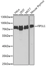 Anti-FIP1L1 antibody used in Western Blot (WB). GTX55623