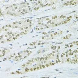 Anti-FIP1L1 antibody used in IHC (Paraffin sections) (IHC-P). GTX55623