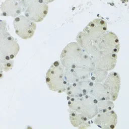 Anti-FIP1L1 antibody used in IHC (Paraffin sections) (IHC-P). GTX55623