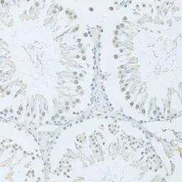 Anti-FIP1L1 antibody used in IHC (Paraffin sections) (IHC-P). GTX55623