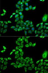 Anti-FMO3 antibody used in Immunocytochemistry/ Immunofluorescence (ICC/IF). GTX55626