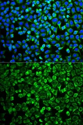 Anti-GAB1 antibody used in Immunocytochemistry/ Immunofluorescence (ICC/IF). GTX55632