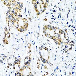 Anti-GAB1 antibody used in IHC (Paraffin sections) (IHC-P). GTX55632