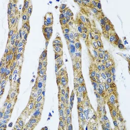 Anti-GAB1 antibody used in IHC (Paraffin sections) (IHC-P). GTX55632
