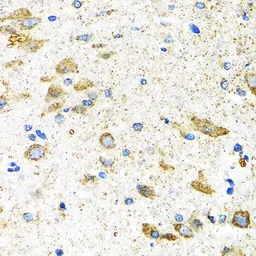 Anti-GAB1 antibody used in IHC (Paraffin sections) (IHC-P). GTX55632