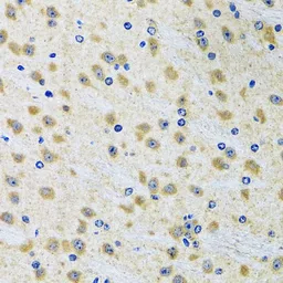 Anti-GAB1 antibody used in IHC (Paraffin sections) (IHC-P). GTX55632
