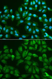 Anti-Galectin 3 antibody used in Immunocytochemistry/ Immunofluorescence (ICC/IF). GTX55633
