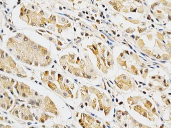 Anti-Galectin 3 antibody used in IHC (Paraffin sections) (IHC-P). GTX55633