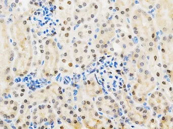 Anti-Galectin 3 antibody used in IHC (Paraffin sections) (IHC-P). GTX55633