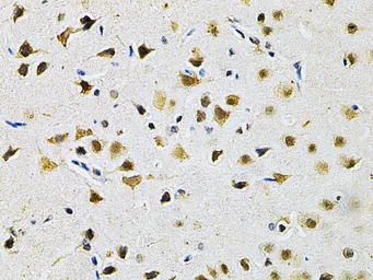 Anti-Galectin 3 antibody used in IHC (Paraffin sections) (IHC-P). GTX55633