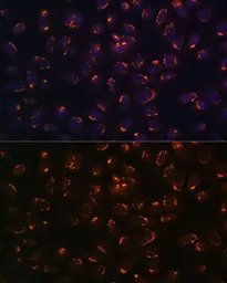Anti-GALNT2 antibody used in Immunocytochemistry/ Immunofluorescence (ICC/IF). GTX55634