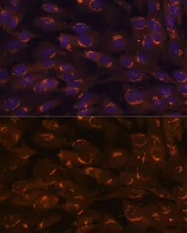Anti-GALNT2 antibody used in Immunocytochemistry/ Immunofluorescence (ICC/IF). GTX55634