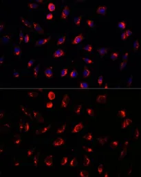 Anti-GALNT2 antibody used in Immunocytochemistry/ Immunofluorescence (ICC/IF). GTX55634