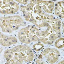 Anti-GALNT2 antibody used in IHC (Paraffin sections) (IHC-P). GTX55634