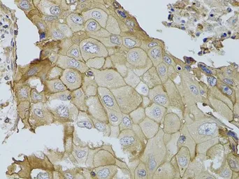 Anti-GGT1 antibody used in IHC (Paraffin sections) (IHC-P). GTX55638