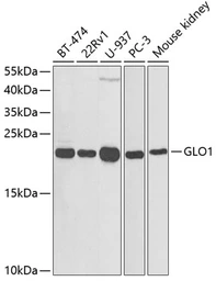 Anti-Glyoxalase I antibody used in Western Blot (WB). GTX55643