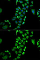 Anti-Glyoxalase I antibody used in Immunocytochemistry/ Immunofluorescence (ICC/IF). GTX55643