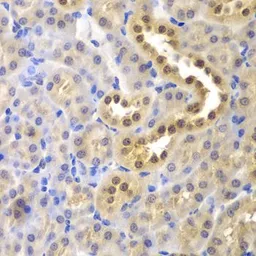 Anti-Glyoxalase I antibody used in IHC (Paraffin sections) (IHC-P). GTX55643