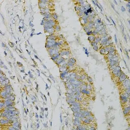 Anti-GNAO1 antibody used in IHC (Paraffin sections) (IHC-P). GTX55644