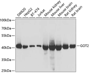 Anti-GOT2 antibody used in Western Blot (WB). GTX55645