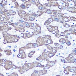 Anti-GOT2 antibody used in IHC (Paraffin sections) (IHC-P). GTX55645