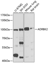 Anti-GRK3 antibody used in Western Blot (WB). GTX55648