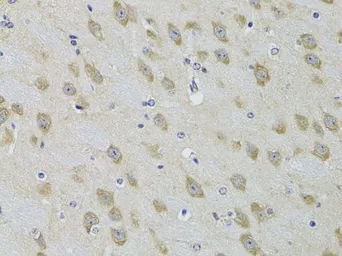 Anti-GRK3 antibody used in IHC (Paraffin sections) (IHC-P). GTX55648