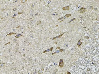 Anti-GRK3 antibody used in IHC (Paraffin sections) (IHC-P). GTX55648
