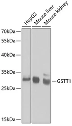 Anti-GSTT1 antibody used in Western Blot (WB). GTX55652