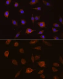 Anti-GSTT1 antibody used in Immunocytochemistry/ Immunofluorescence (ICC/IF). GTX55652