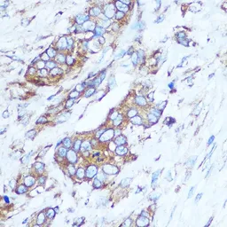 Anti-GSTT1 antibody used in IHC (Paraffin sections) (IHC-P). GTX55652