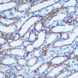 Anti-GSTT1 antibody used in IHC (Paraffin sections) (IHC-P). GTX55652