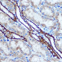Anti-GSTT1 antibody used in IHC (Paraffin sections) (IHC-P). GTX55652