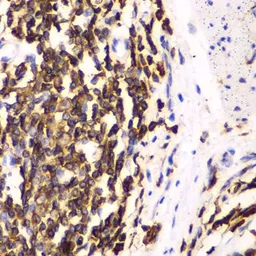 Anti-HCLS1 antibody used in IHC (Paraffin sections) (IHC-P). GTX55654