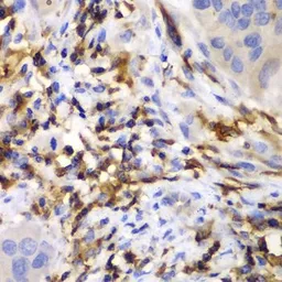 Anti-HCLS1 antibody used in IHC (Paraffin sections) (IHC-P). GTX55654