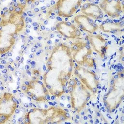 Anti-HCLS1 antibody used in IHC (Paraffin sections) (IHC-P). GTX55654