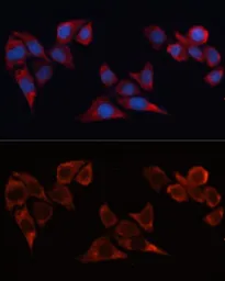 Anti-Heme Oxygenase 1 antibody used in Immunocytochemistry/ Immunofluorescence (ICC/IF). GTX55656