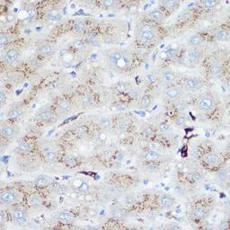 Anti-Heme Oxygenase 1 antibody used in IHC (Paraffin sections) (IHC-P). GTX55656