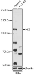 Anti-Hexokinase II antibody used in Western Blot (WB). GTX55657