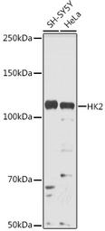 Anti-Hexokinase II antibody used in Western Blot (WB). GTX55657