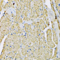 Anti-Hexokinase II antibody used in IHC (Paraffin sections) (IHC-P). GTX55657