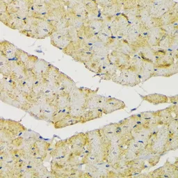 Anti-Hexokinase II antibody used in IHC (Paraffin sections) (IHC-P). GTX55657
