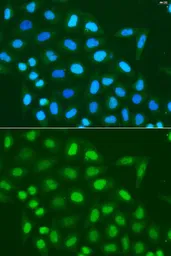 Anti-Histone H3 antibody used in Immunocytochemistry/ Immunofluorescence (ICC/IF). GTX55659