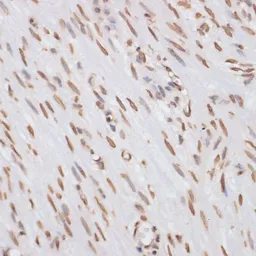 Anti-Histone H3 antibody used in IHC (Paraffin sections) (IHC-P). GTX55659